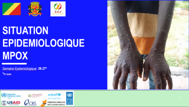Epidémie de Mpox : Rapport de Situation (SITREP) S26-27